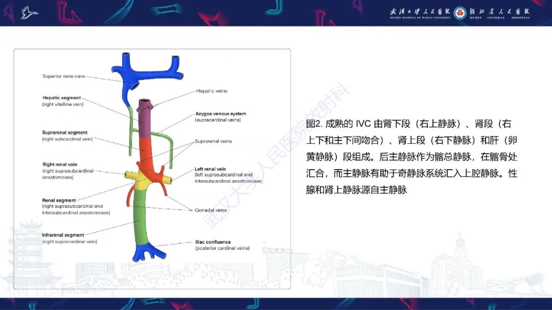 影像PPT - 【PPT】下腔静脉解剖变异及病变影像诊断-5