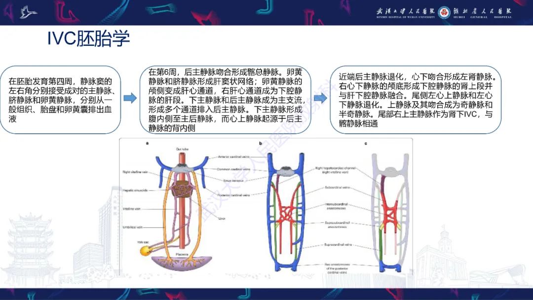 影像PPT - 【PPT】下腔静脉解剖变异及病变影像诊断-4