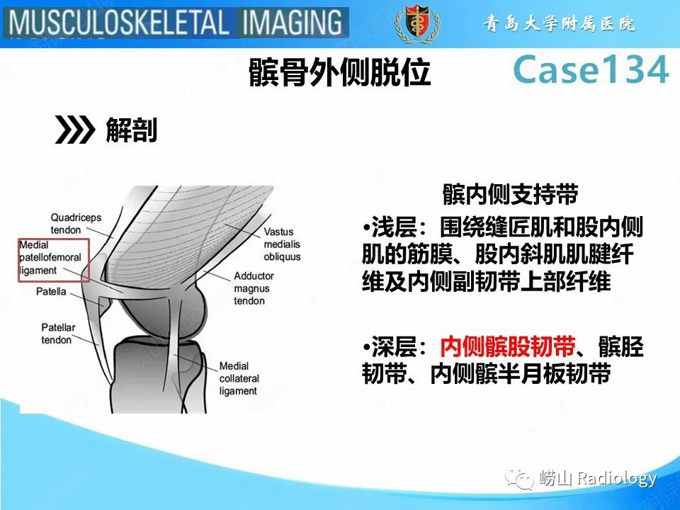 影像PPT - 【PPT】髌骨外侧脱位-8