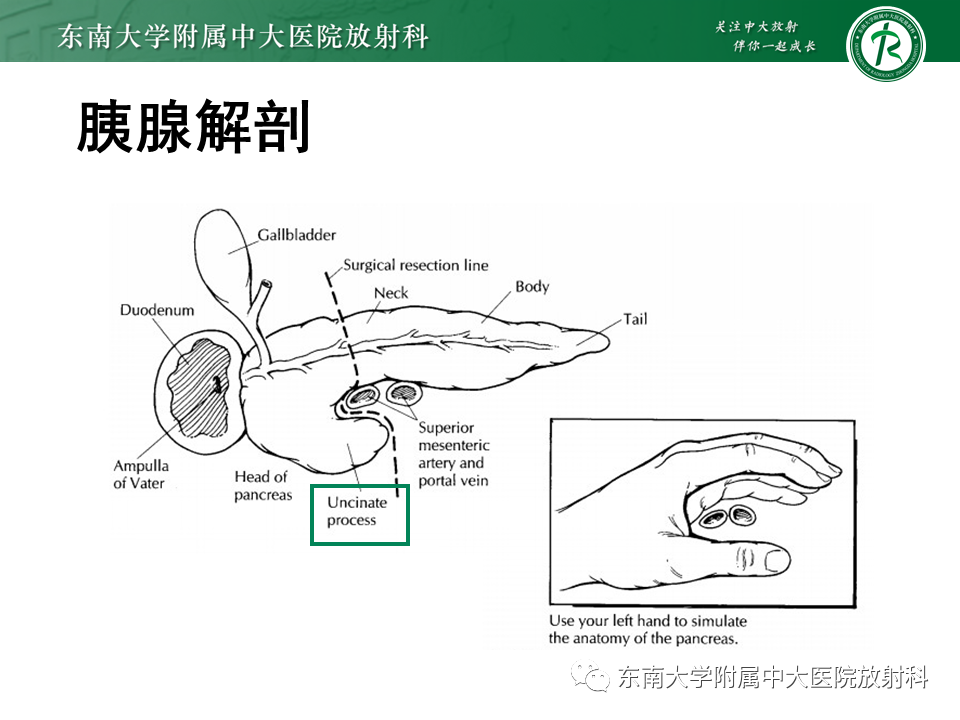 影像PPT - 【PPT】胰腺常见囊性病变影像表现-7