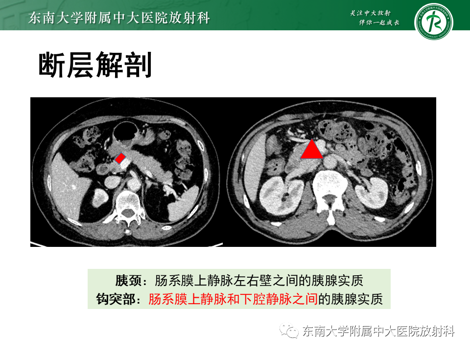 影像PPT - 【PPT】胰腺常见囊性病变影像表现-8