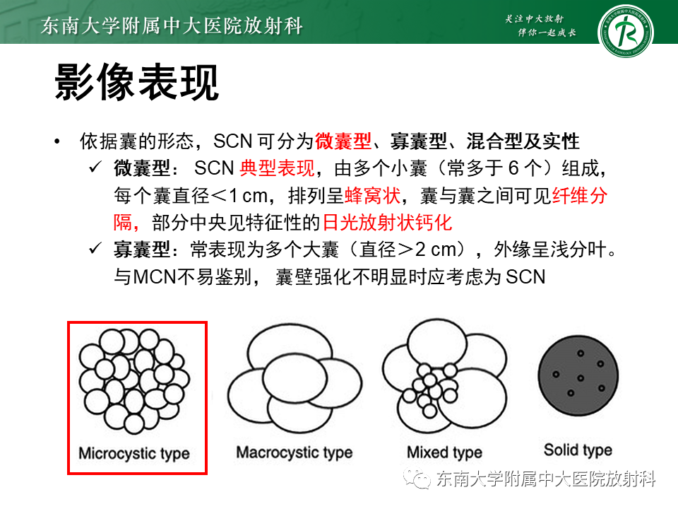 影像PPT - 【PPT】胰腺常见囊性病变影像表现-18
