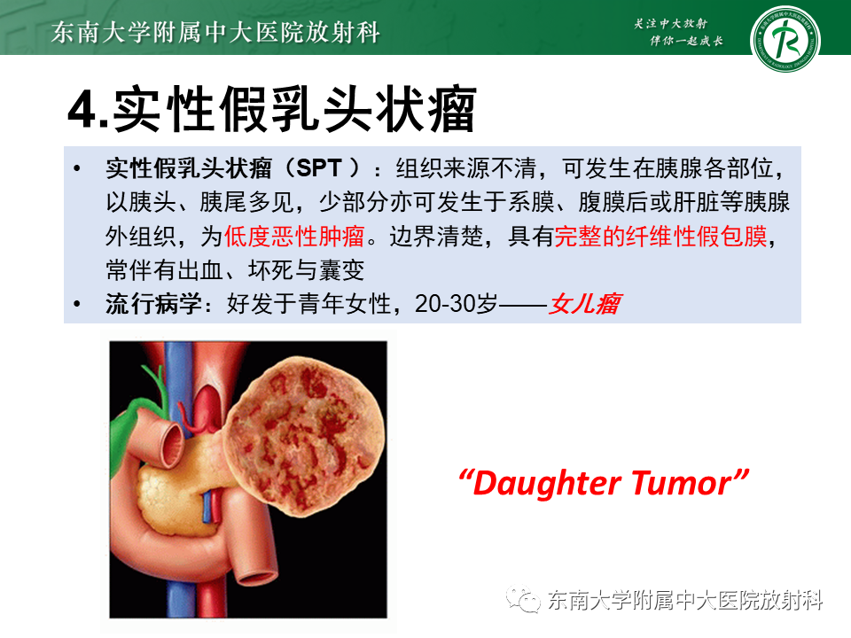 影像PPT - 【PPT】胰腺常见囊性病变影像表现-29