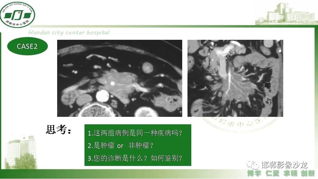 影像PPT - 【PPT】硬化性肠系膜炎-3