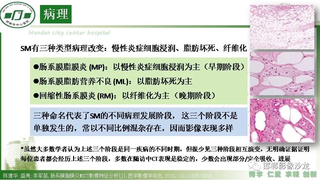 影像PPT - 【PPT】硬化性肠系膜炎-7