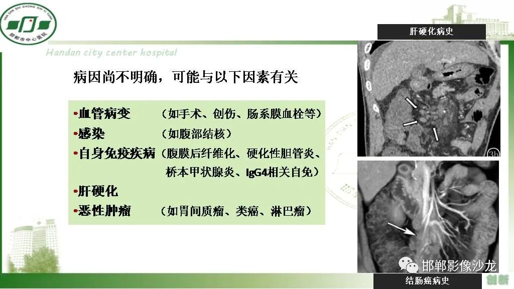 影像PPT - 【PPT】硬化性肠系膜炎-6
