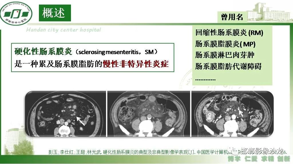 影像PPT - 【PPT】硬化性肠系膜炎-4