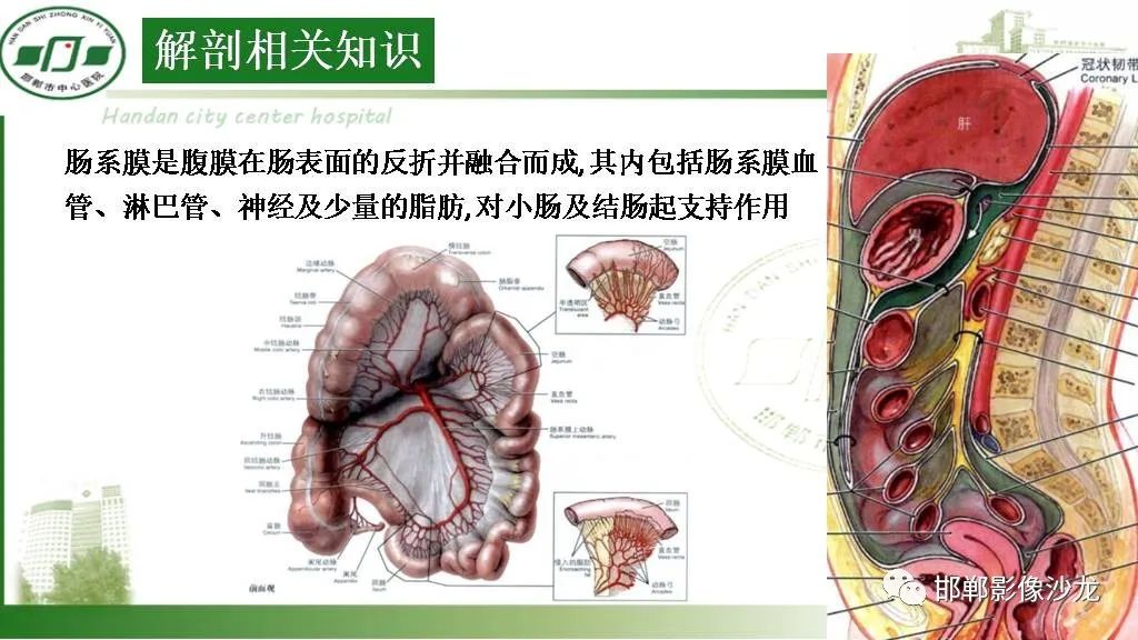 影像PPT - 【PPT】硬化性肠系膜炎-8