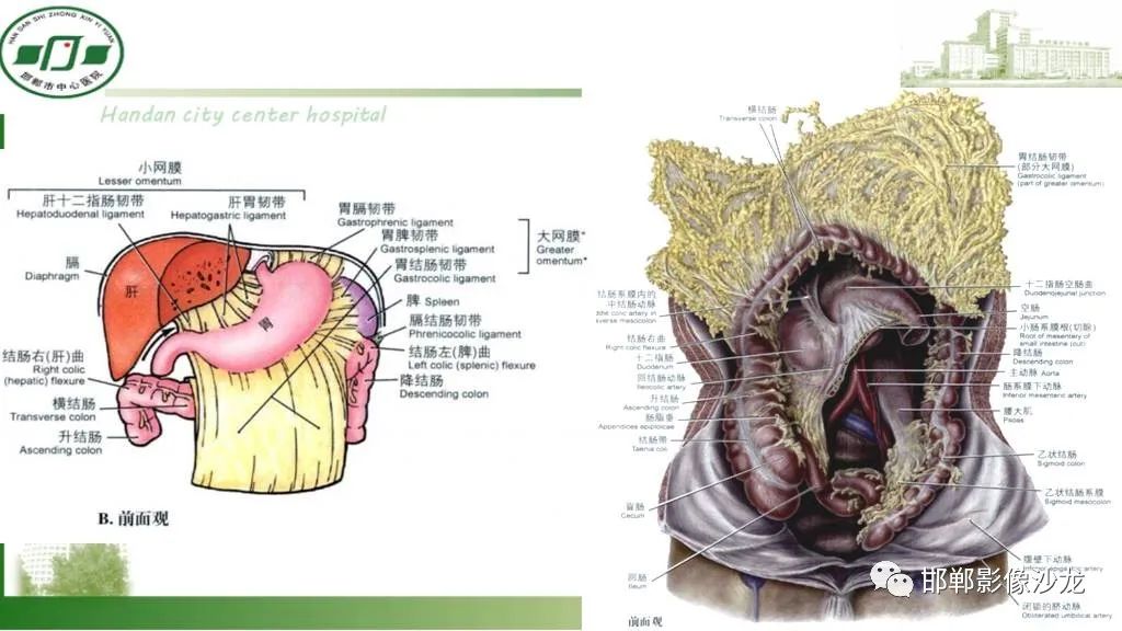 影像PPT - 【PPT】硬化性肠系膜炎-10
