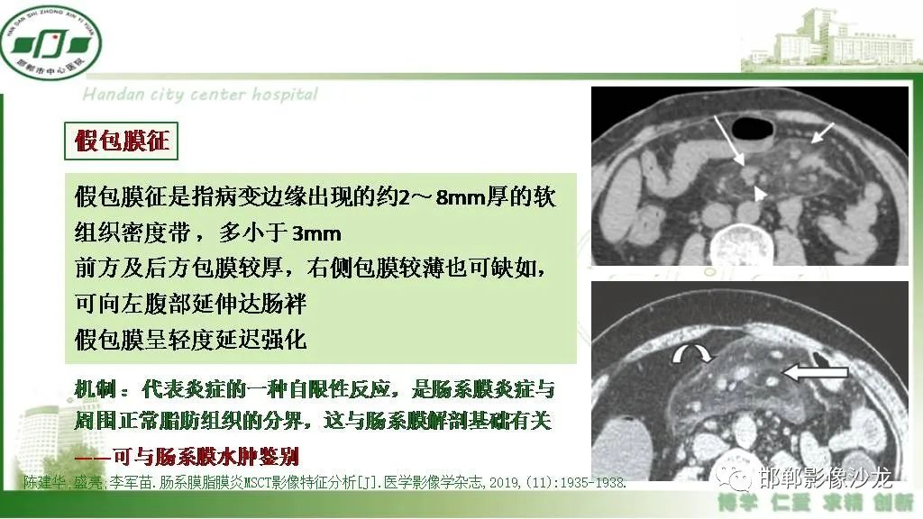 影像PPT - 【PPT】硬化性肠系膜炎-14