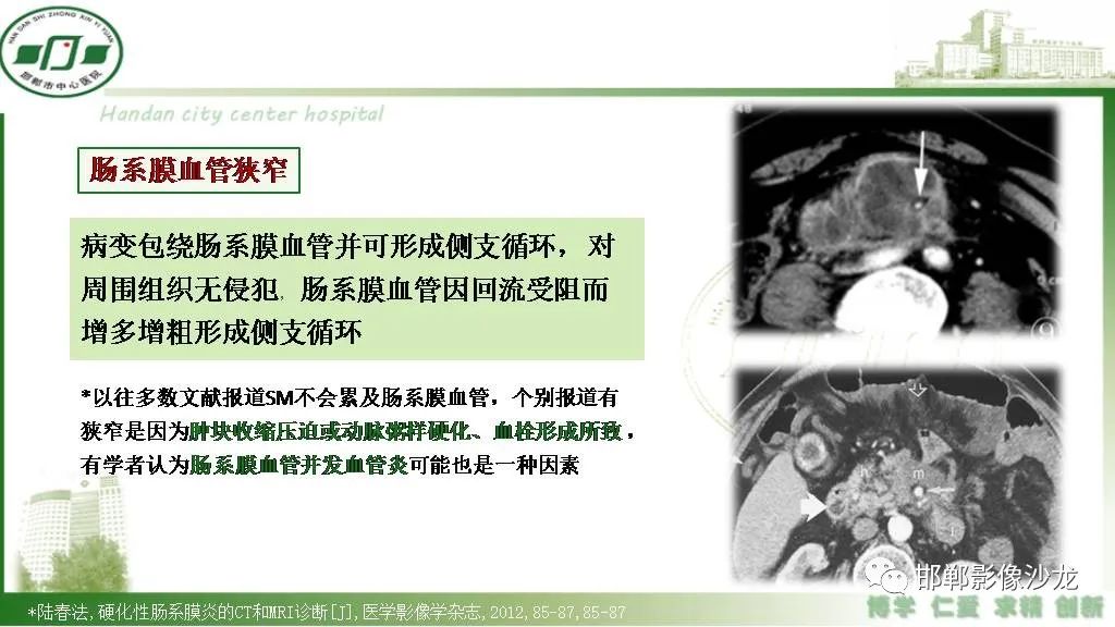 影像PPT - 【PPT】硬化性肠系膜炎-17