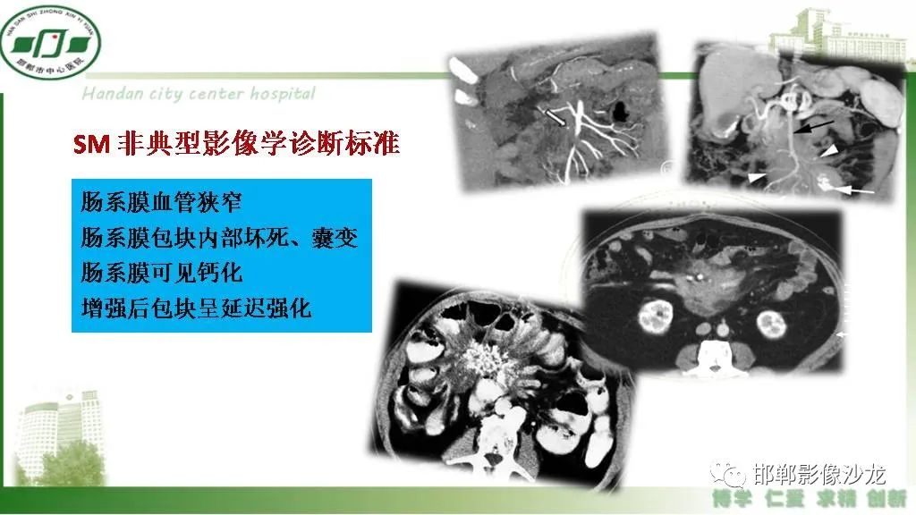 影像PPT - 【PPT】硬化性肠系膜炎-16