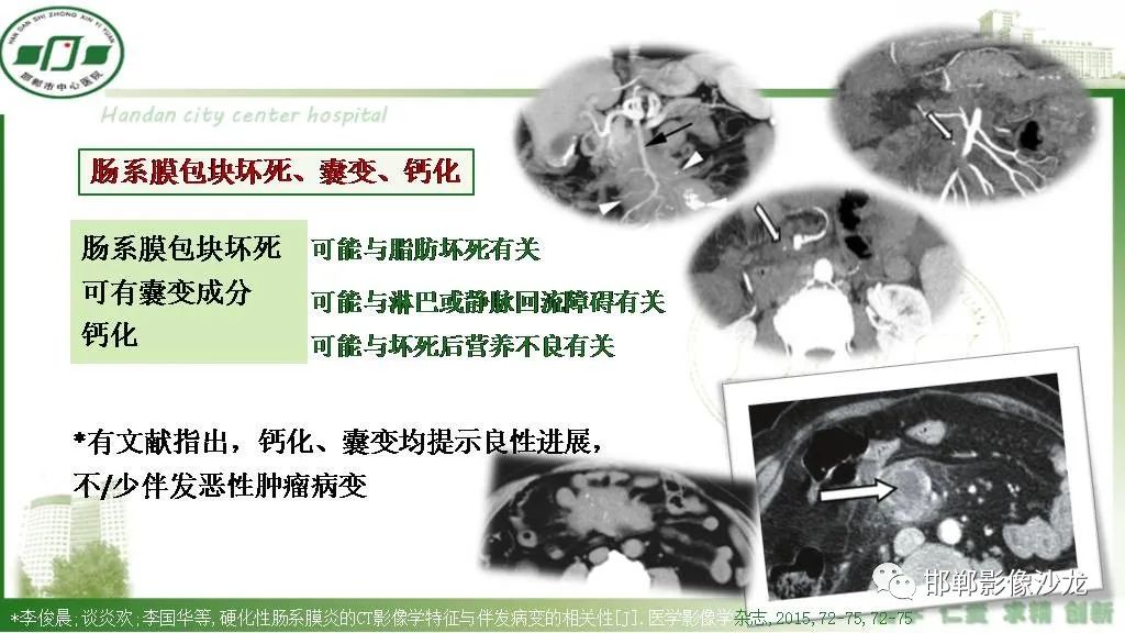 影像PPT - 【PPT】硬化性肠系膜炎-20