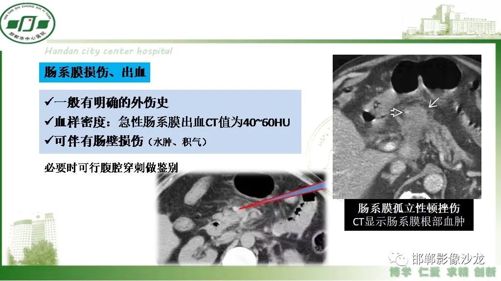 影像PPT - 【PPT】硬化性肠系膜炎-25