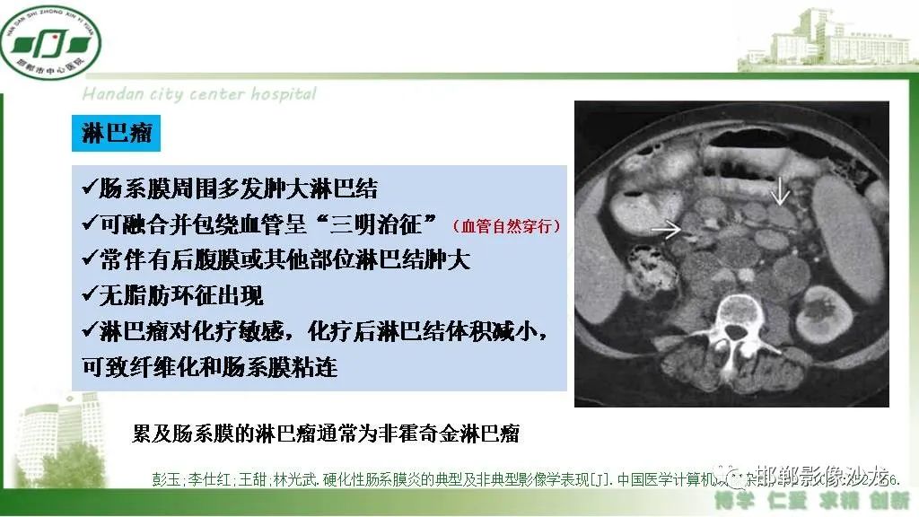 影像PPT - 【PPT】硬化性肠系膜炎-28