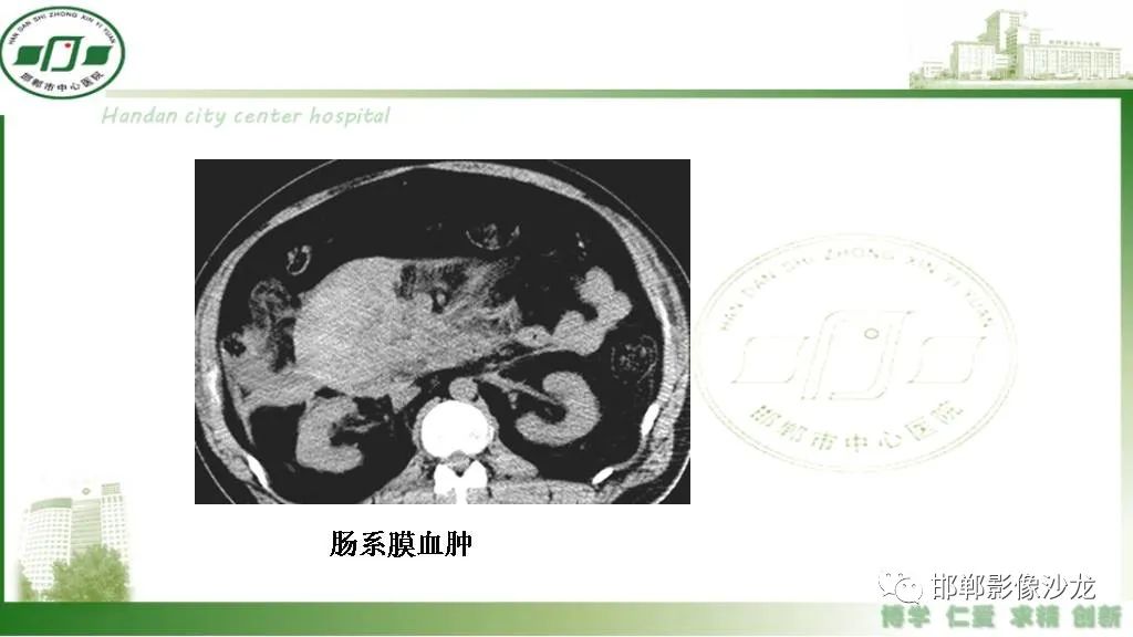 影像PPT - 【PPT】硬化性肠系膜炎-26