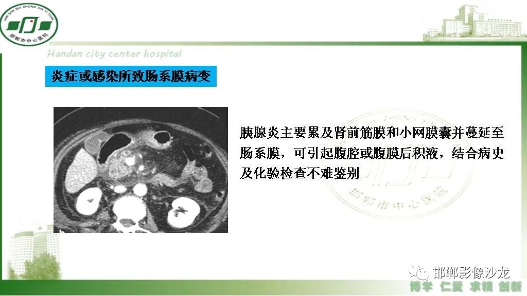 影像PPT - 【PPT】硬化性肠系膜炎-35