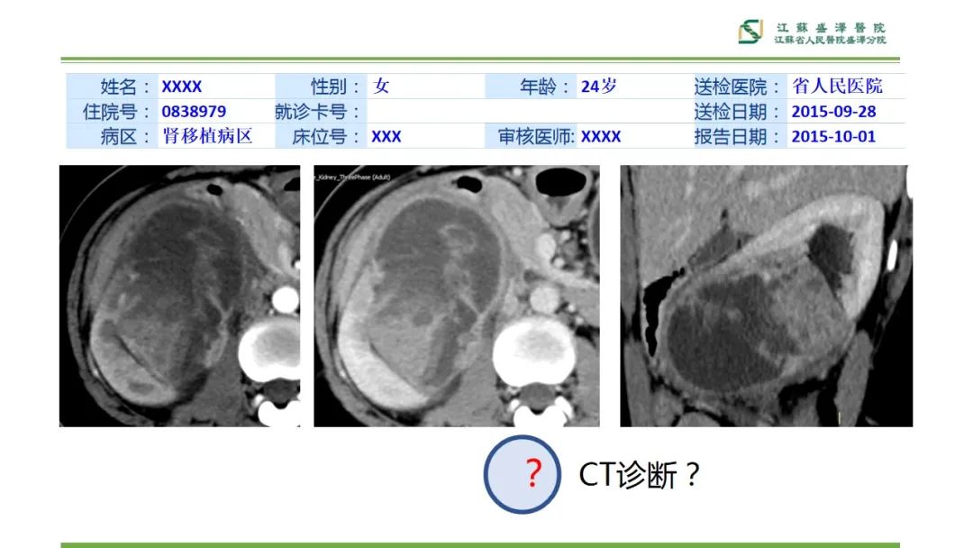 影像PPT - 【PPT】肾脏实性肿瘤的良恶性鉴别--影像诊断思路分析-18