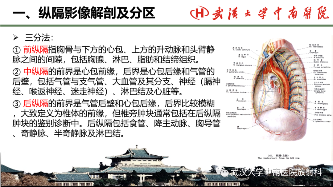 影像PPT - 【PPT】纵隔影像解剖、纵隔肿瘤定位及前纵隔肿瘤和瘤样病变-4