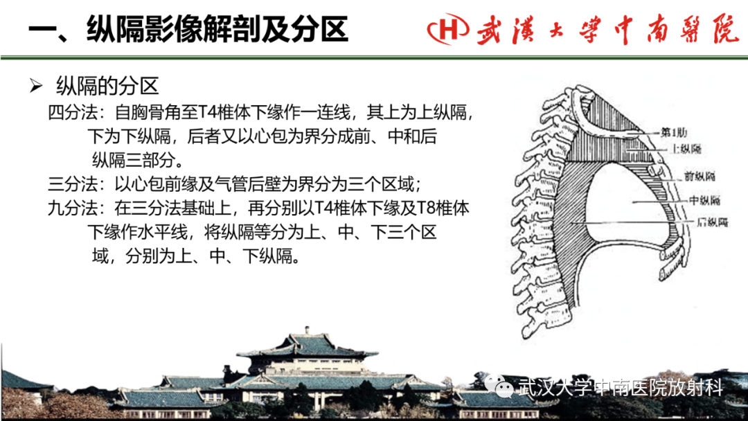 影像PPT - 【PPT】纵隔影像解剖、纵隔肿瘤定位及前纵隔肿瘤和瘤样病变-3