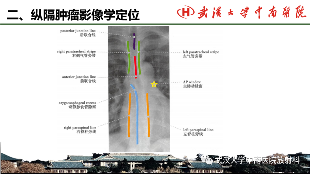 影像PPT - 【PPT】纵隔影像解剖、纵隔肿瘤定位及前纵隔肿瘤和瘤样病变-5
