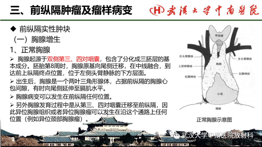 影像PPT - 【PPT】纵隔影像解剖、纵隔肿瘤定位及前纵隔肿瘤和瘤样病变-22