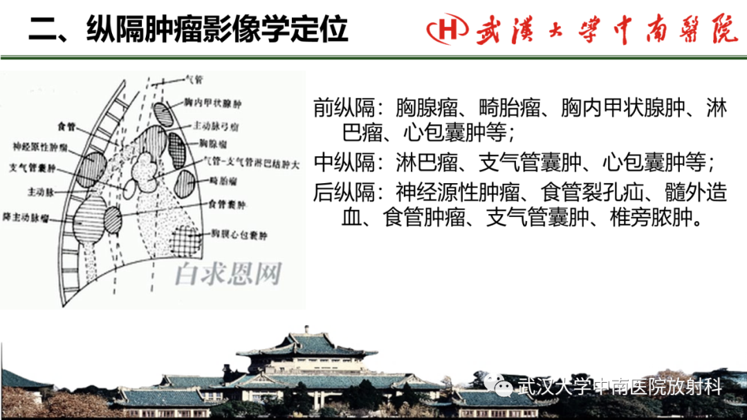 影像PPT - 【PPT】纵隔影像解剖、纵隔肿瘤定位及前纵隔肿瘤和瘤样病变-20