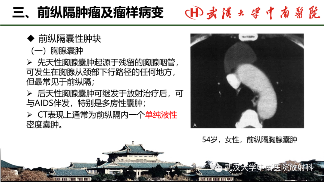 影像PPT - 【PPT】纵隔影像解剖、纵隔肿瘤定位及前纵隔肿瘤和瘤样病变-55
