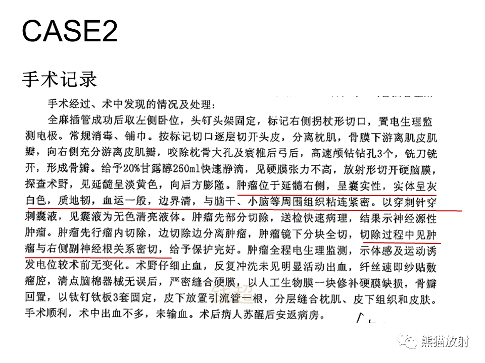 影像PPT - 【病例】颅内神经鞘瘤2例MR影像-27