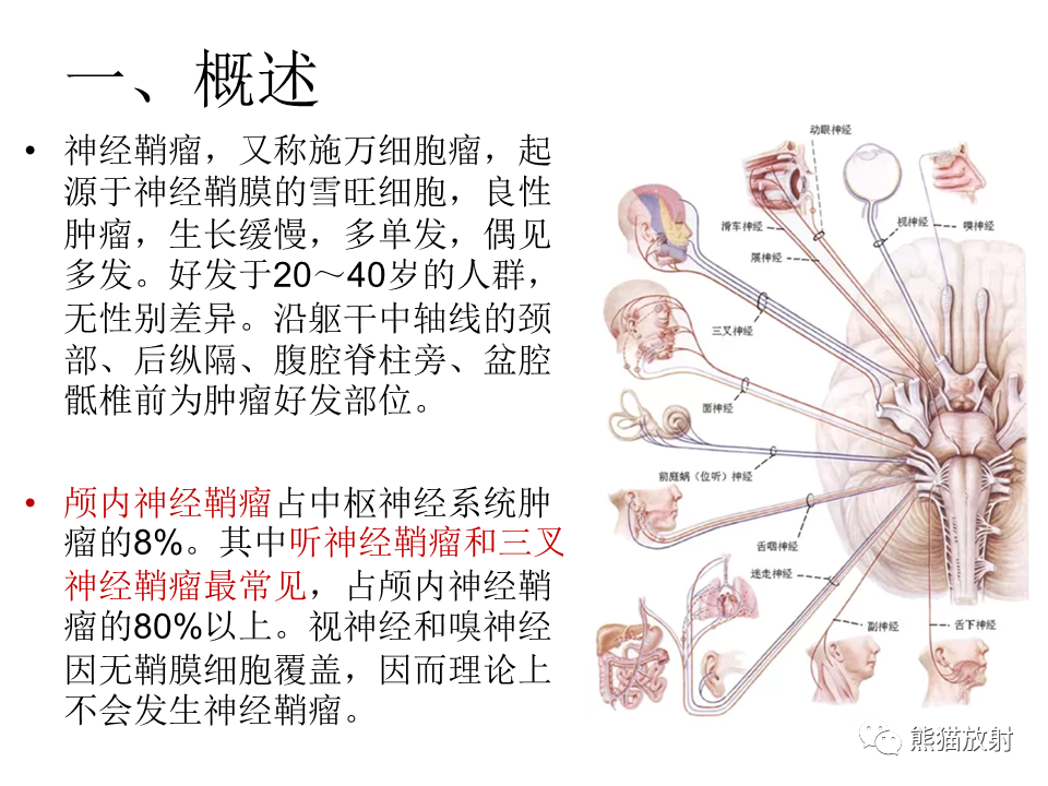 影像PPT - 【病例】颅内神经鞘瘤2例MR影像-29