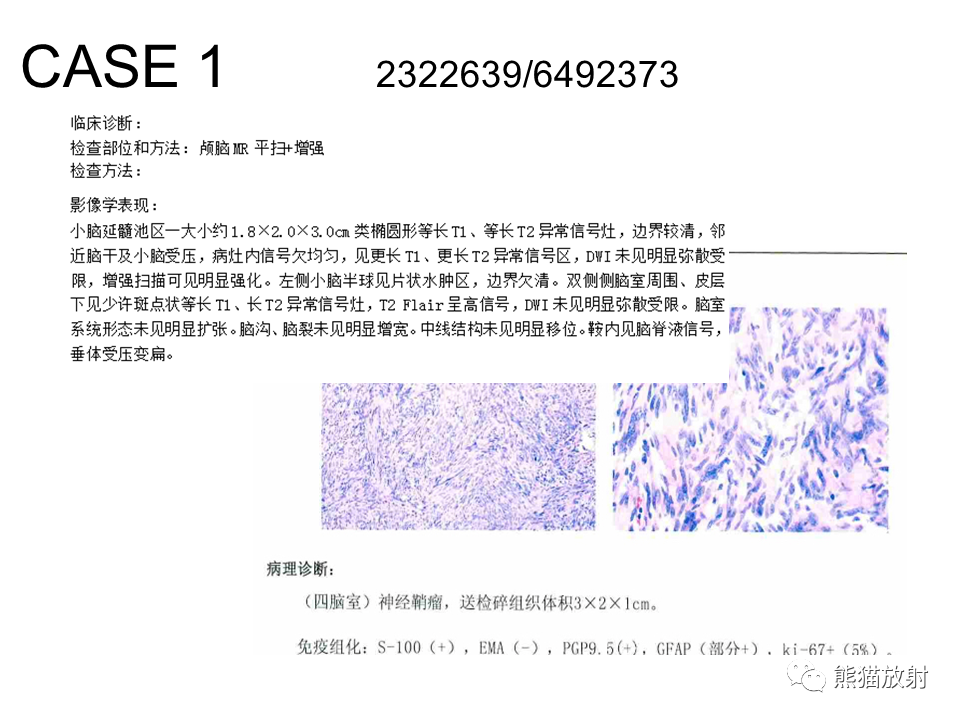 影像PPT - 【病例】颅内神经鞘瘤2例MR影像-24
