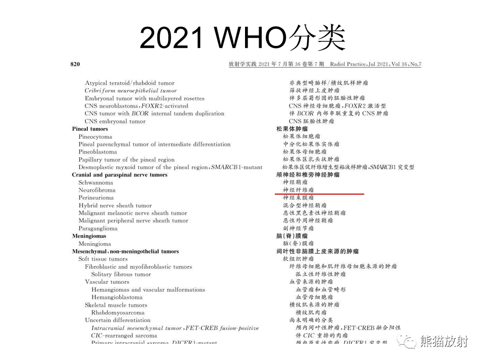 影像PPT - 【病例】颅内神经鞘瘤2例MR影像-30