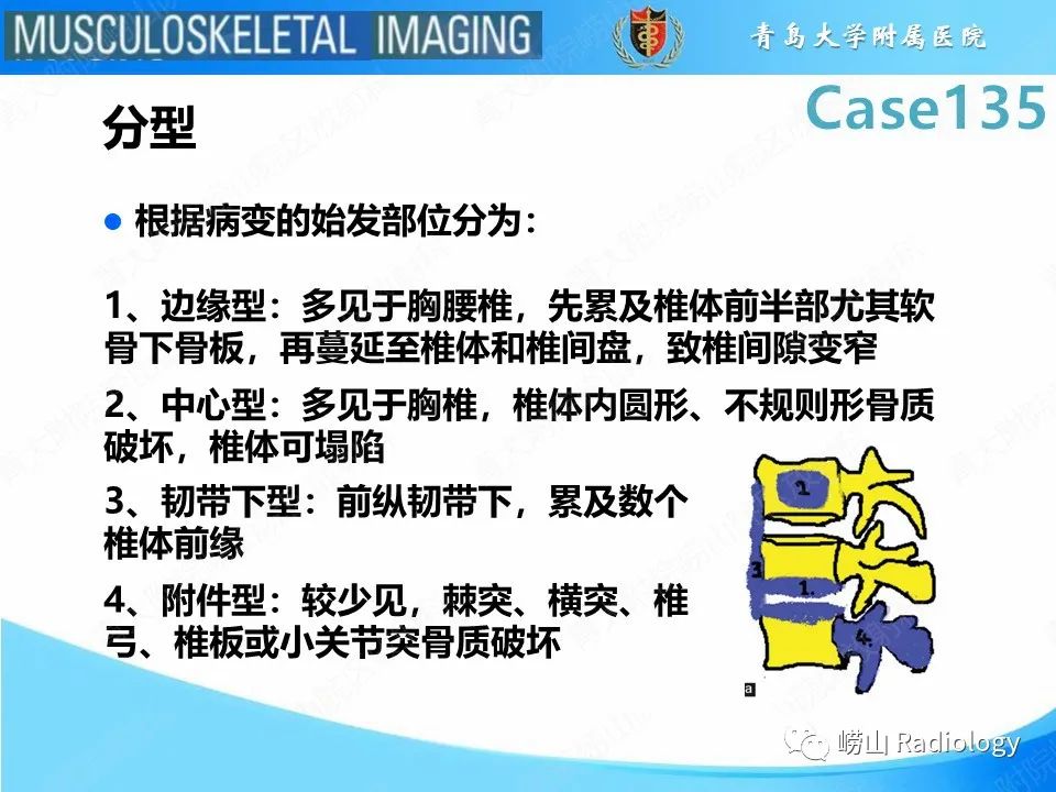 影像PPT - 【PPT】脊柱结核-16