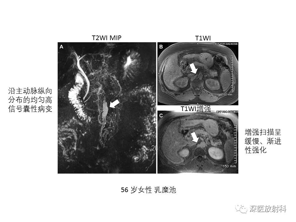 影像PPT - 【PPT】原发性腹膜后囊性病变影像学特征-34