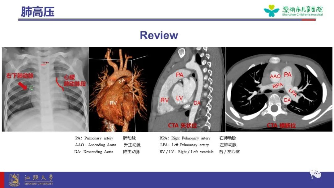 影像PPT - 【PPT】肺血管疾病-5