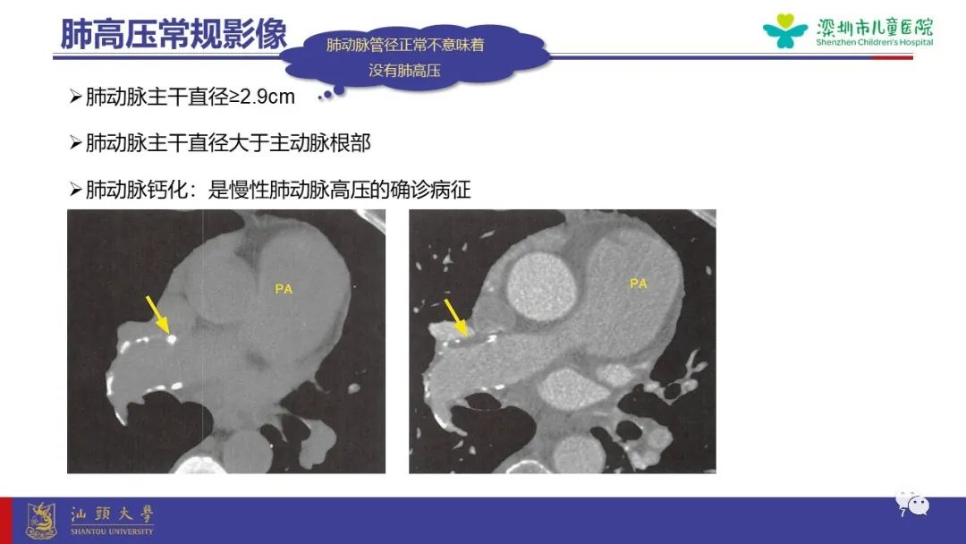 影像PPT - 【PPT】肺血管疾病-7