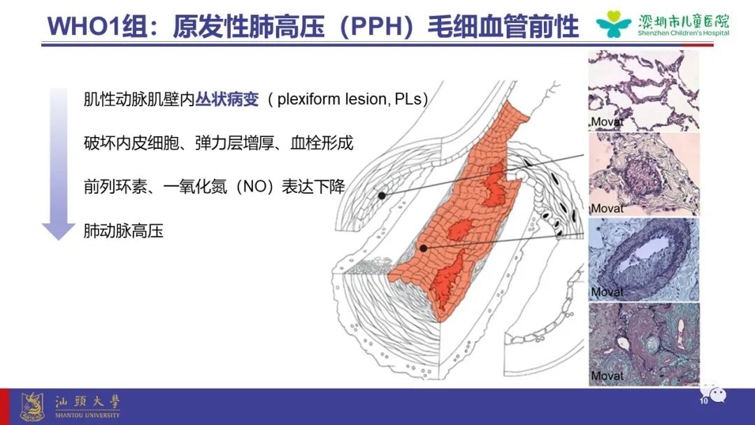 影像PPT - 【PPT】肺血管疾病-10