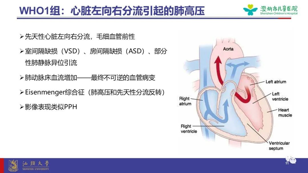 影像PPT - 【PPT】肺血管疾病-11