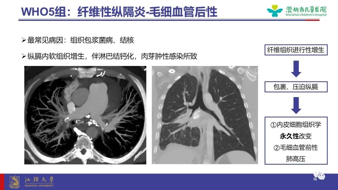 影像PPT - 【PPT】肺血管疾病-16