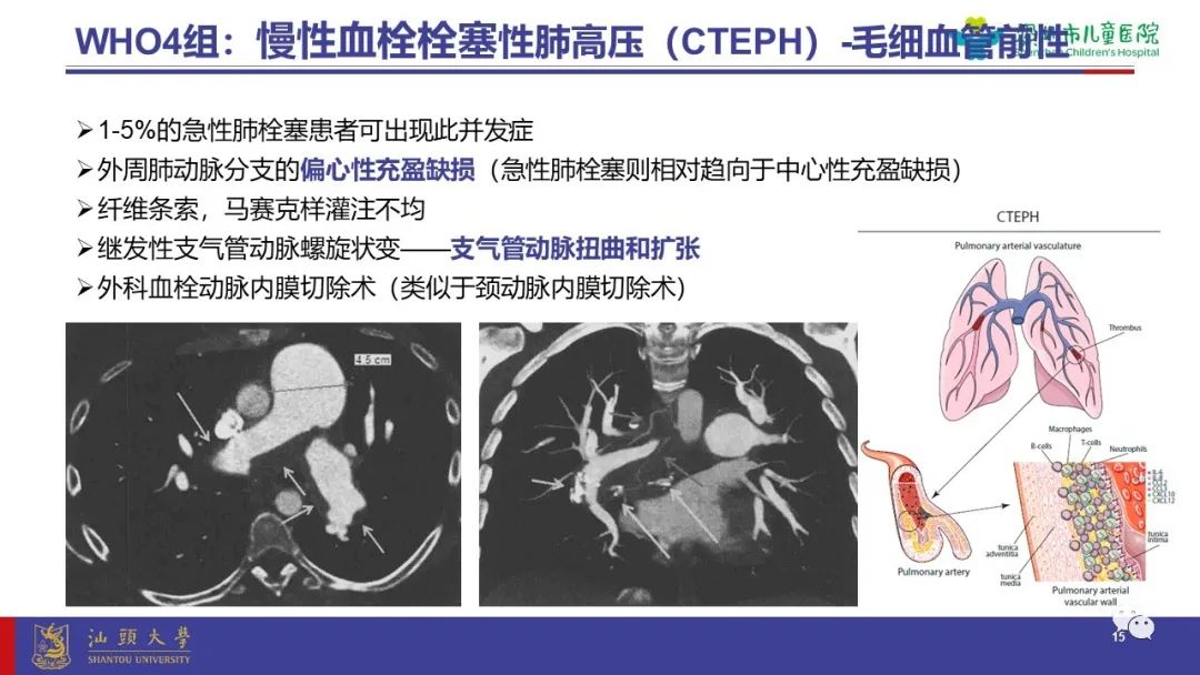 影像PPT - 【PPT】肺血管疾病-15