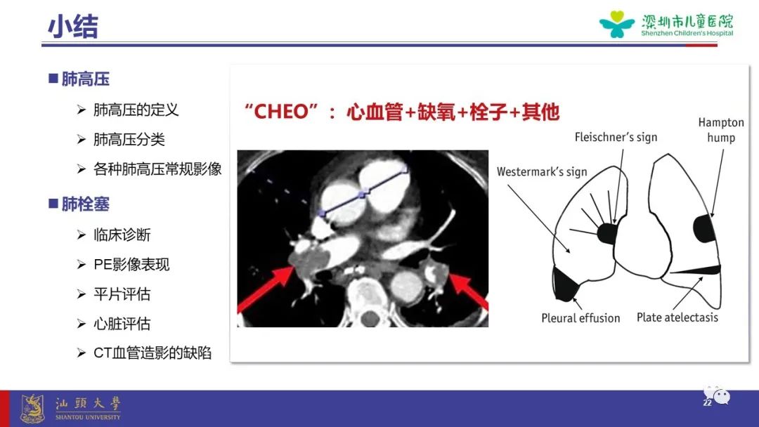 影像PPT - 【PPT】肺血管疾病-22