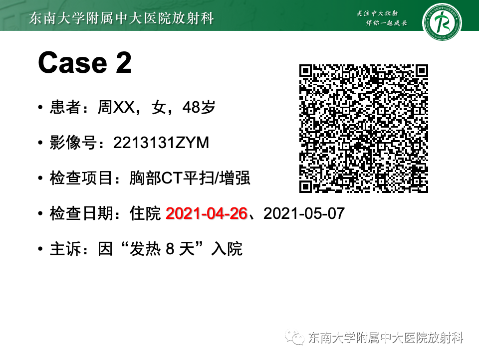影像PPT - 【PPT】非典型性肺炎—以鹦鹉热衣原体感染为例-9
