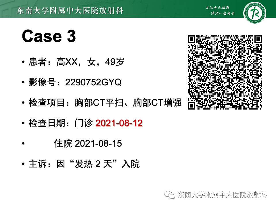 影像PPT - 【PPT】非典型性肺炎—以鹦鹉热衣原体感染为例-14