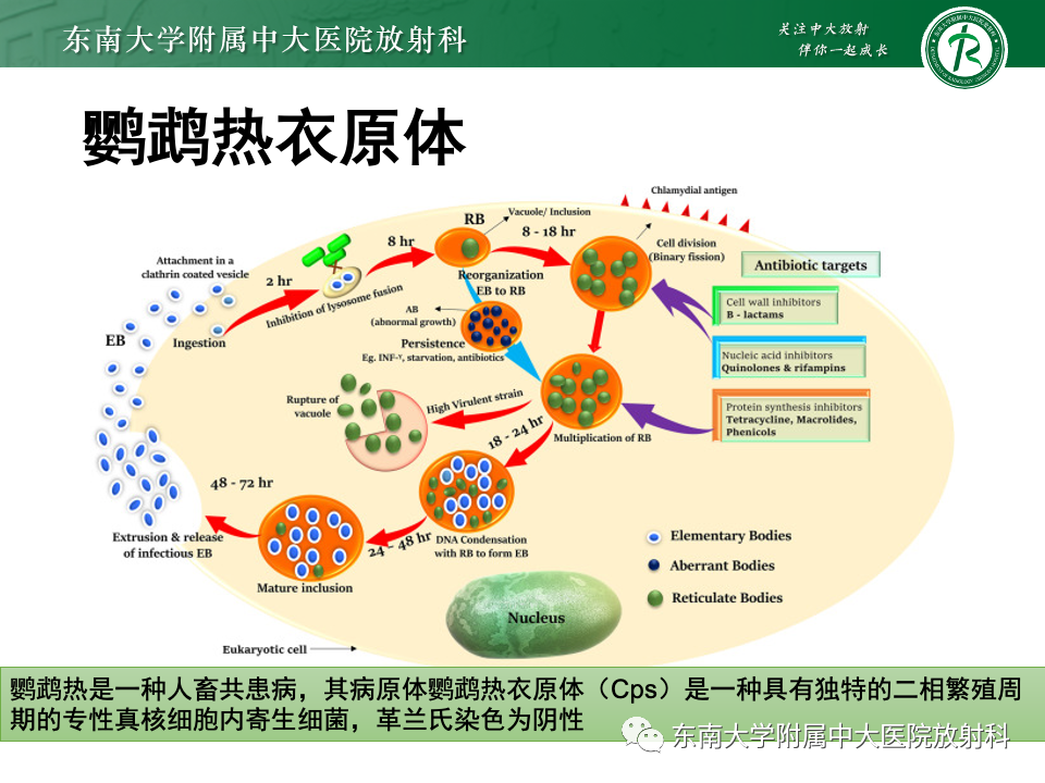 影像PPT - 【PPT】非典型性肺炎—以鹦鹉热衣原体感染为例-30