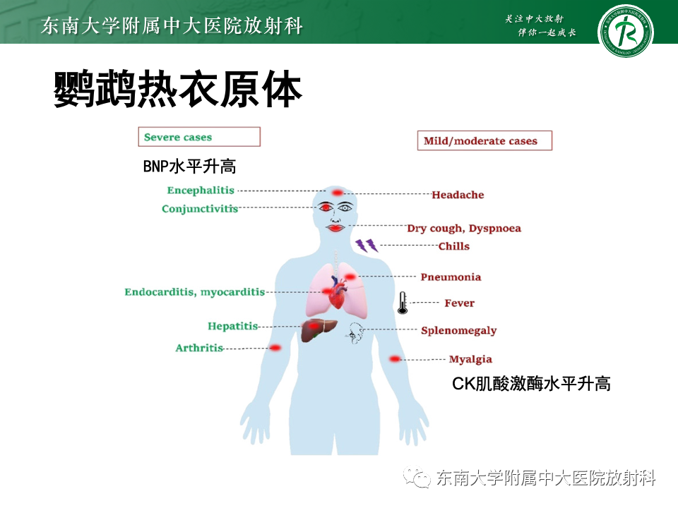 影像PPT - 【PPT】非典型性肺炎—以鹦鹉热衣原体感染为例-31