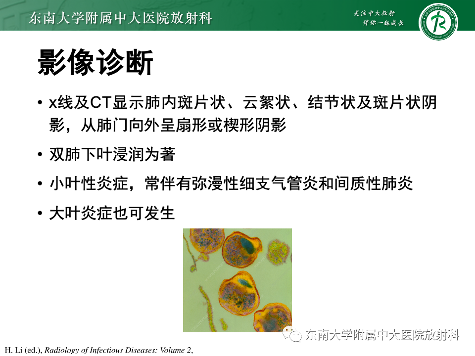 影像PPT - 【PPT】非典型性肺炎—以鹦鹉热衣原体感染为例-33