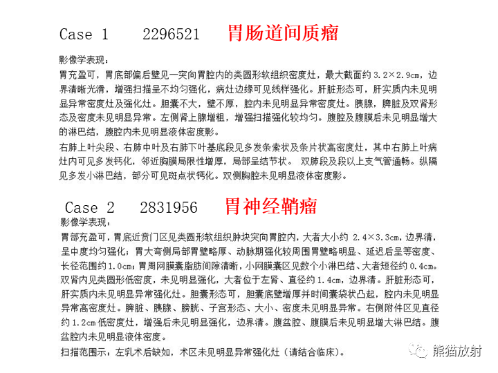 影像PPT - 【病例】胃间质瘤VS神经鞘瘤-16