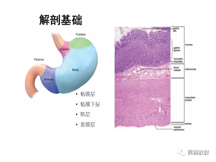影像PPT - 【病例】胃间质瘤VS神经鞘瘤-17