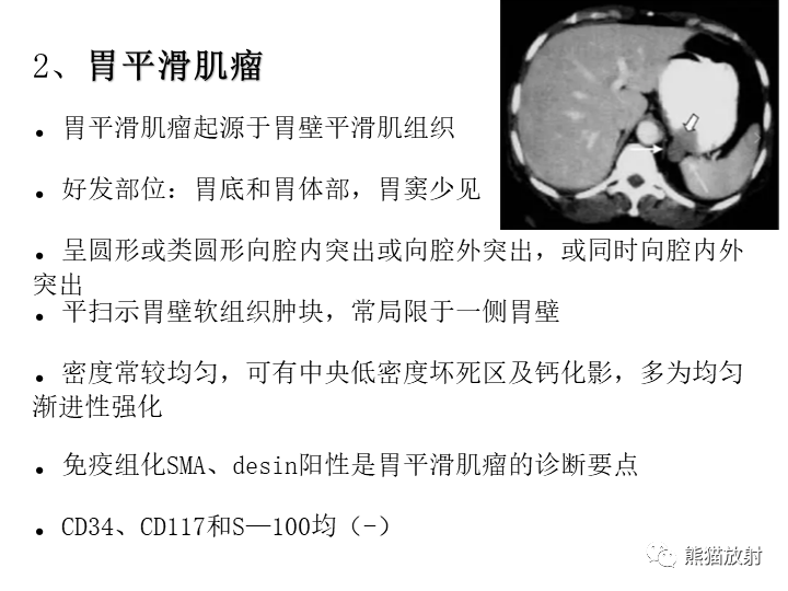 影像PPT - 【病例】胃间质瘤VS神经鞘瘤-24