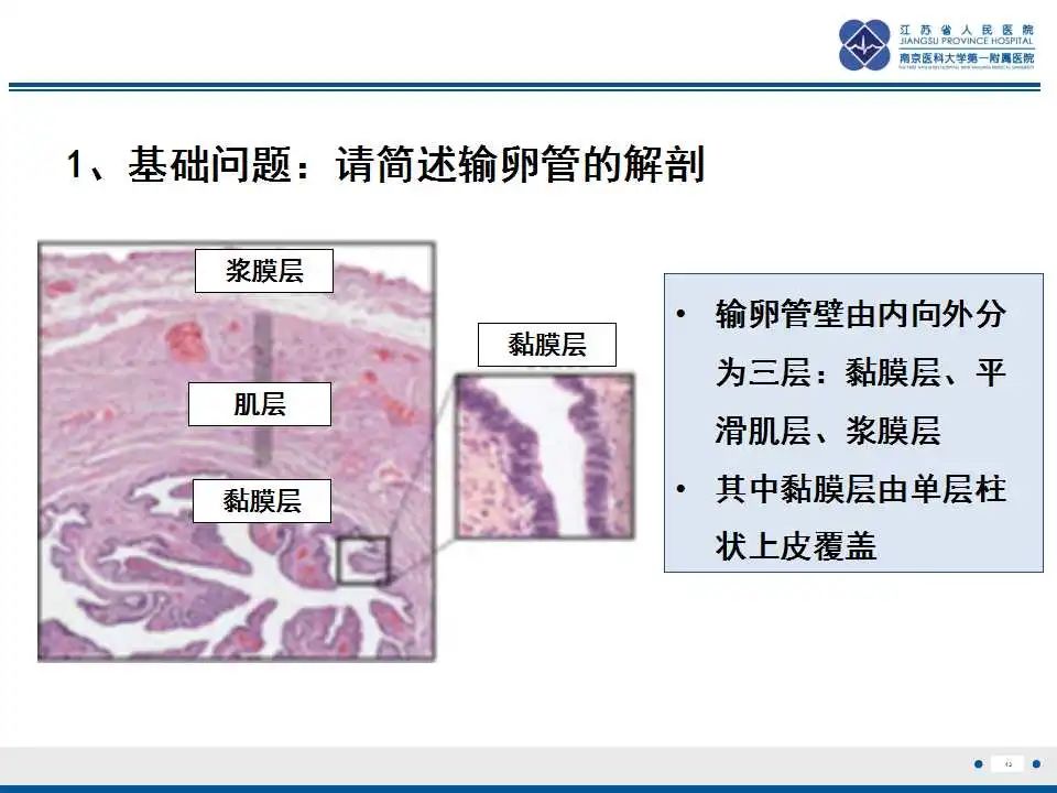 影像PPT - 【PPT】原发性输卵管癌-14